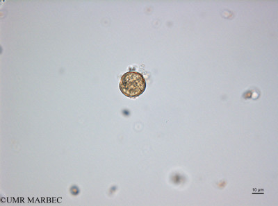 phyto/Bizerte/bizerte_lagoon/RISCO February 2015/Nd d (ancien Lagune_T5_CW2_Triceratium160204_001_ovl-4).tif(copy)_thumb.jpg